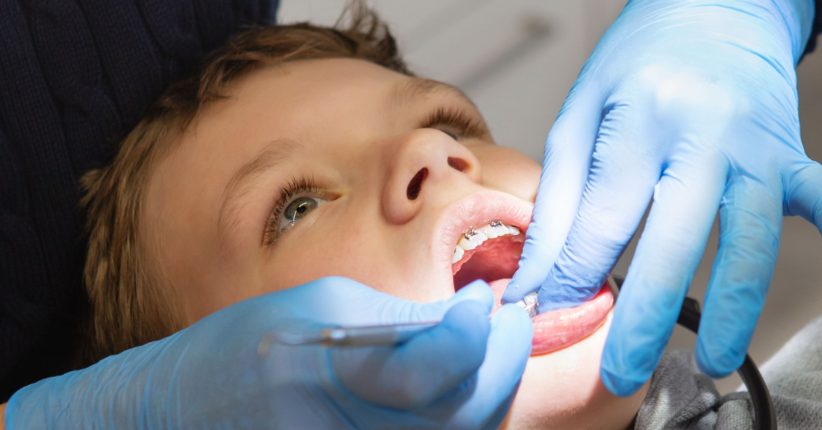 Revolutionizing Children's Dental Care: The Role of AI in Pediatric Dentistry